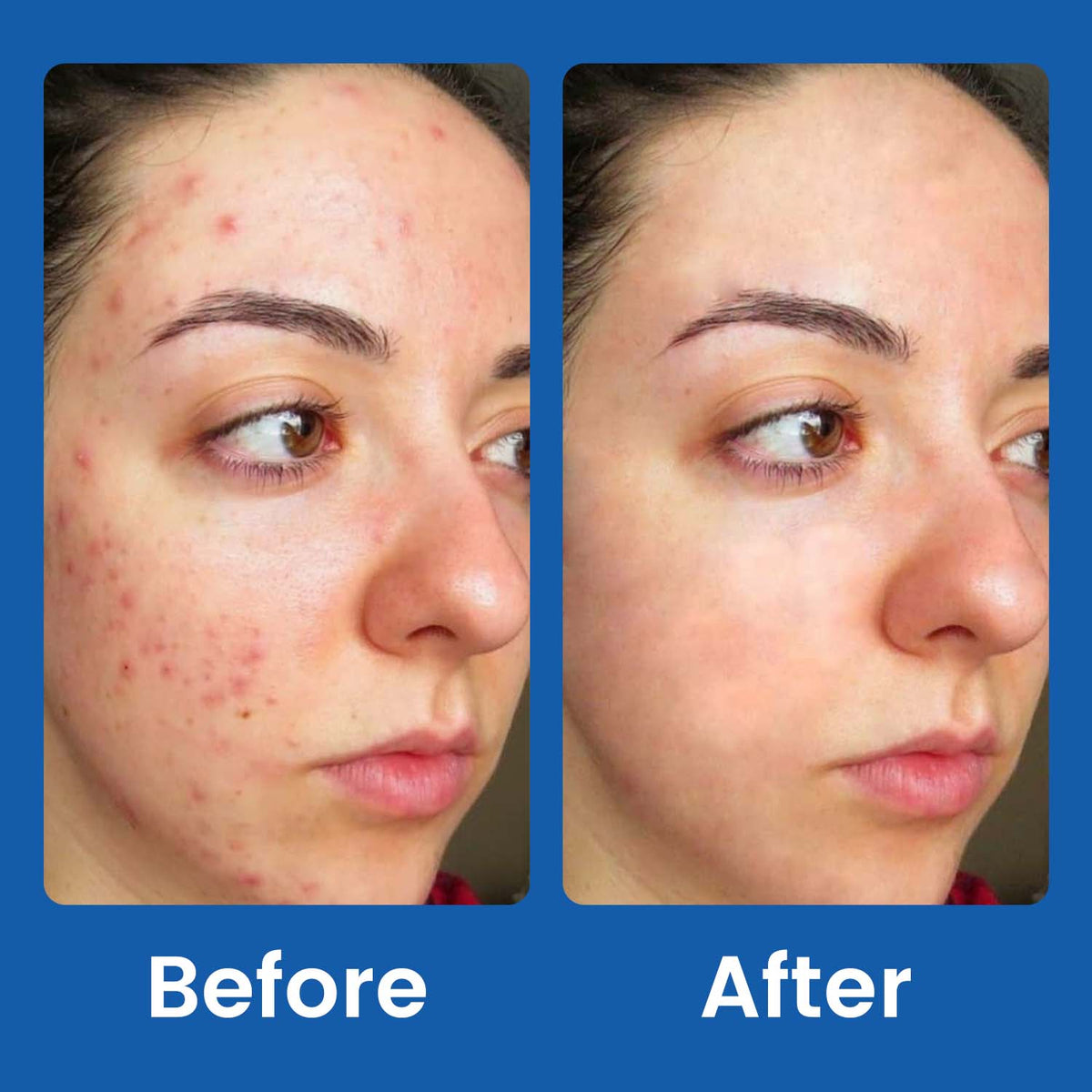 Private Label Facial Cleanser for All Skin Types Gentle Face Wash