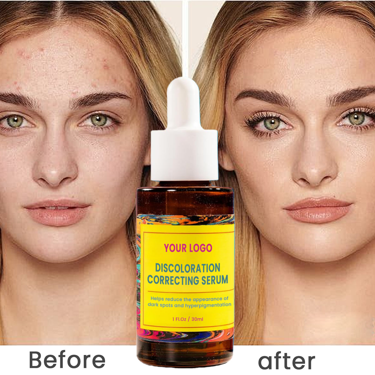 Private Label Discoloration Correcting Serum Even Tone Facial Serum